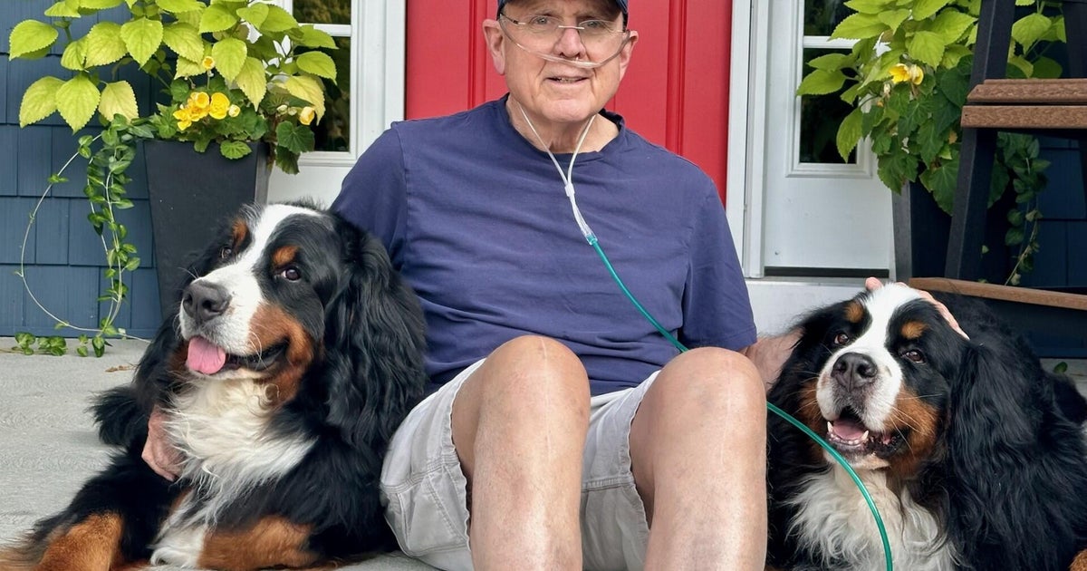 A dog trainer had no symptoms. A scan of his lungs found a terminal disease - CBS News