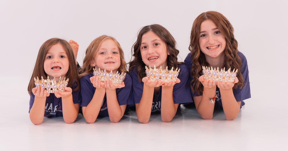 Sisters with mysterious symptoms diagnosed with same rare brain condition: