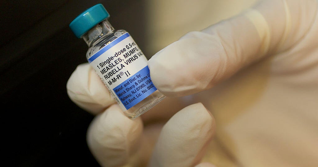 Trump's call to split up the MMR childhood vaccine revives long-settled debate - CBS News