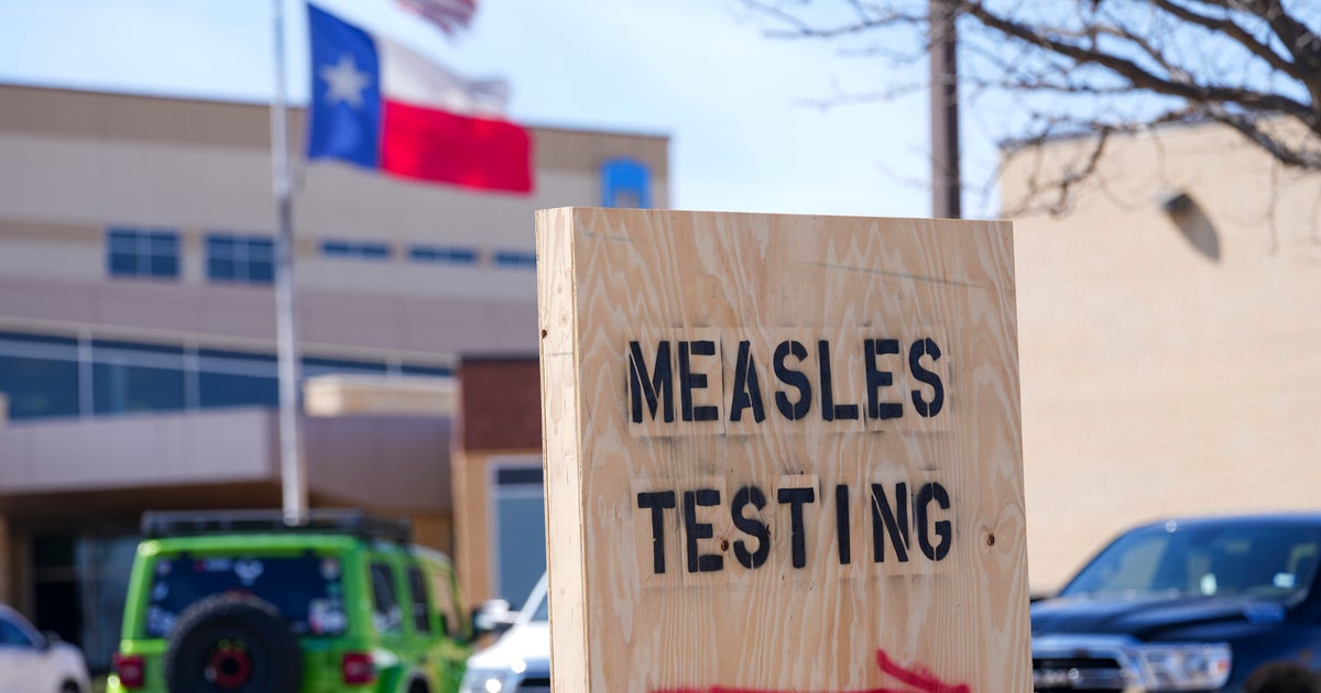 As measles outbreaks grow in the U.S., maps and charts show a record number of cases - CBS News