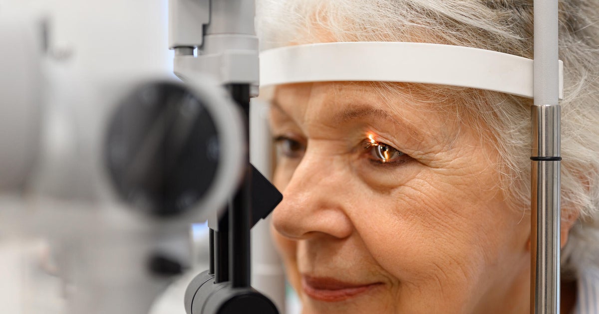 Medicare's paying less for cataract surgery. Eye doctors are turning to moneymaking lasers. - CBS News