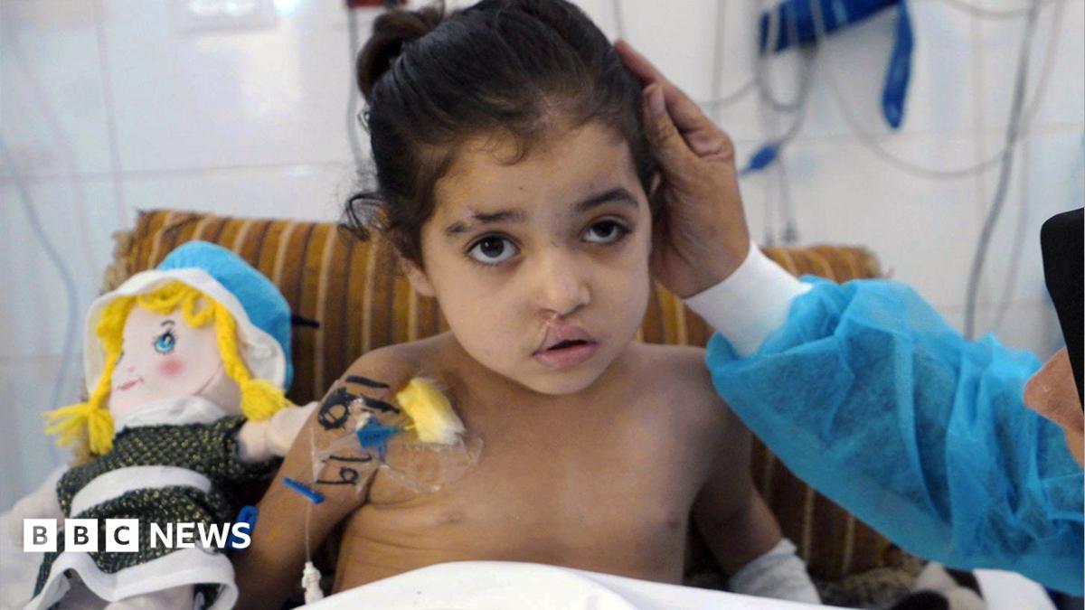 Girl has multiple surgeries to control infections after strike in Gaza - BBC News